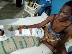 Medium_iyabo-batu-at-the-benin-teaching-hospital-during-his-surgery